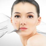 home remedies to remove dark spots on face - relish doze