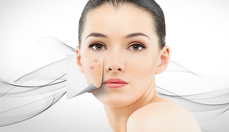home remedies to remove dark spots on face - relish doze