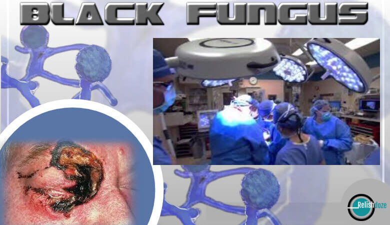 Black Fungus [Mucormycosis]: Major Symptoms, Treatment and How it is different from Skin based fungal infection